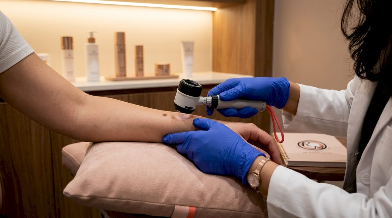 Dermatologist examining mole with dermatoscope