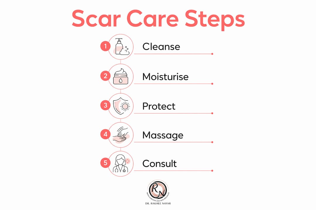Infographic showing surgical scar care steps