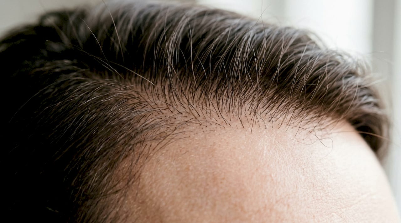 Close-up of healthy scalp hair follicles