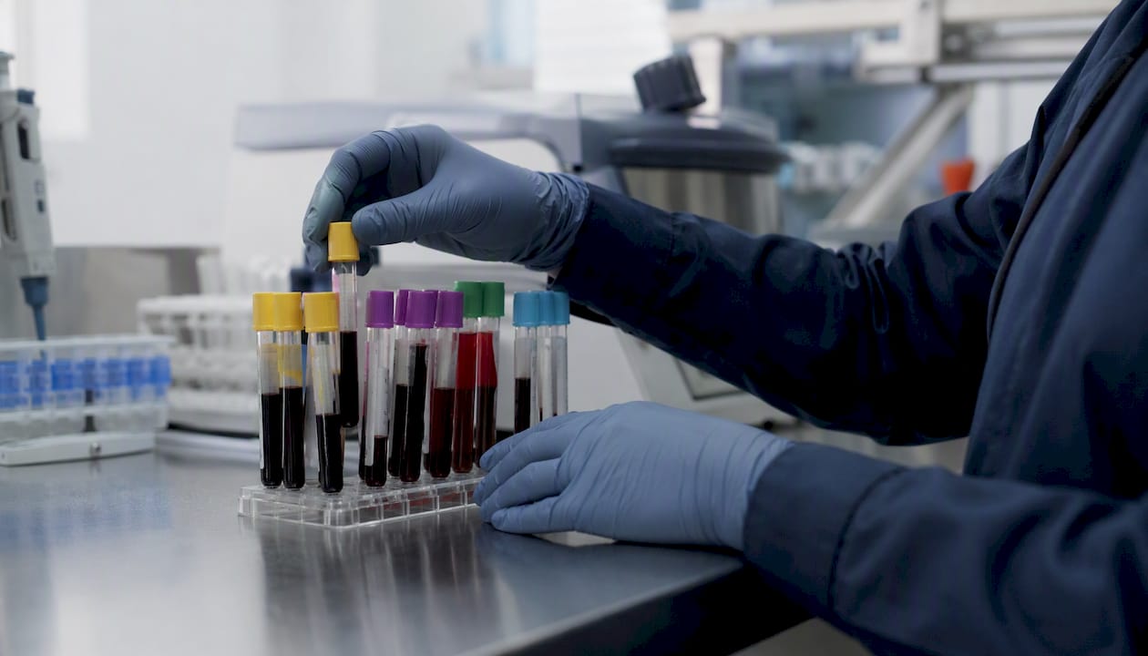 Hands holding anticoagulant blood collection tubes
