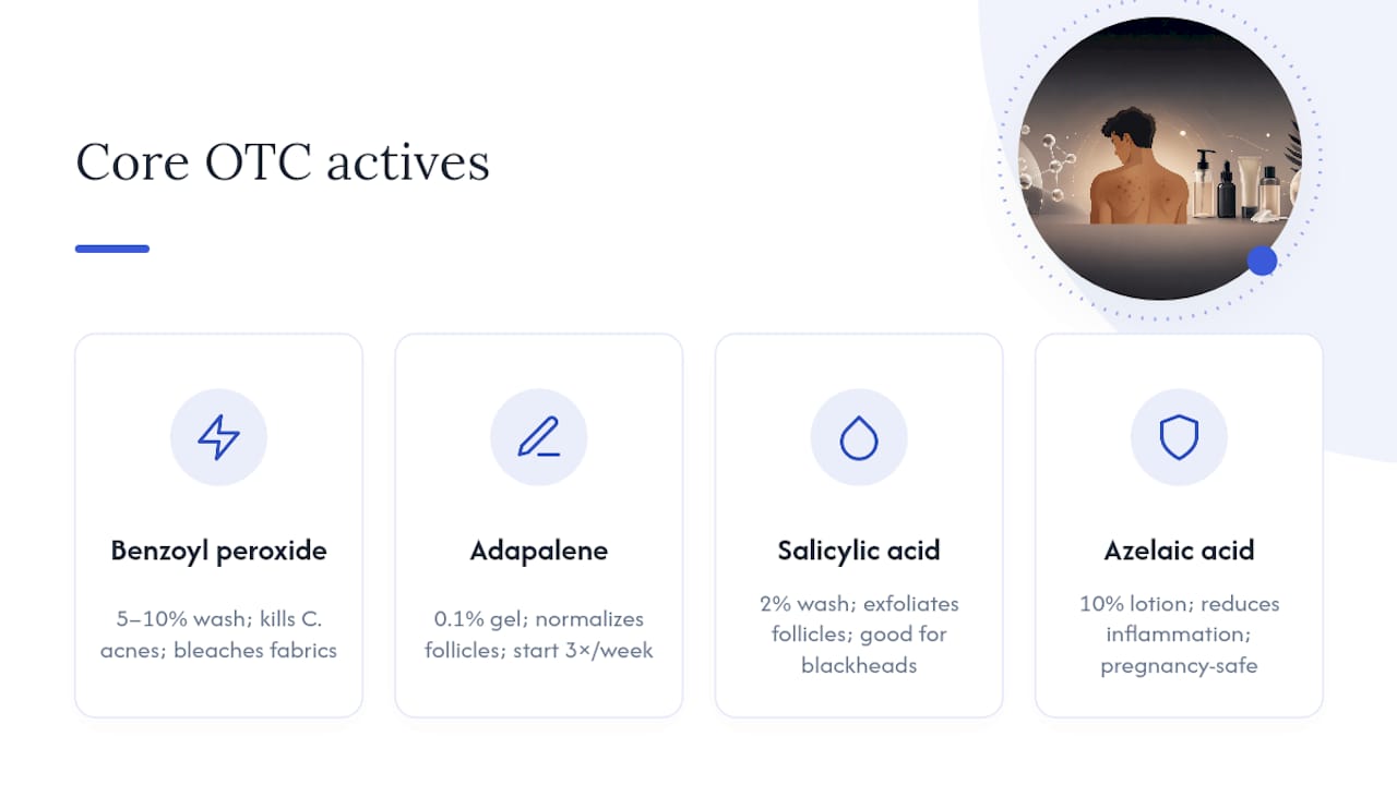 Diagram comparing four OTC acne treatment actives