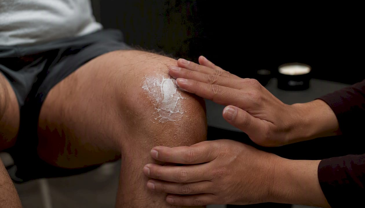 Hands applying urea cream on thick palm scales