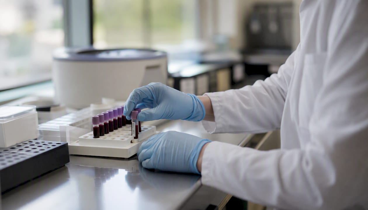 Clinician handling blood sample vial in lab