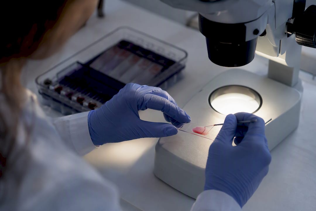 Hands preparing blood smear slide under microscope
