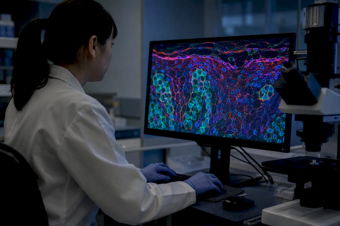 Confocal microscopy image of melanoma cells