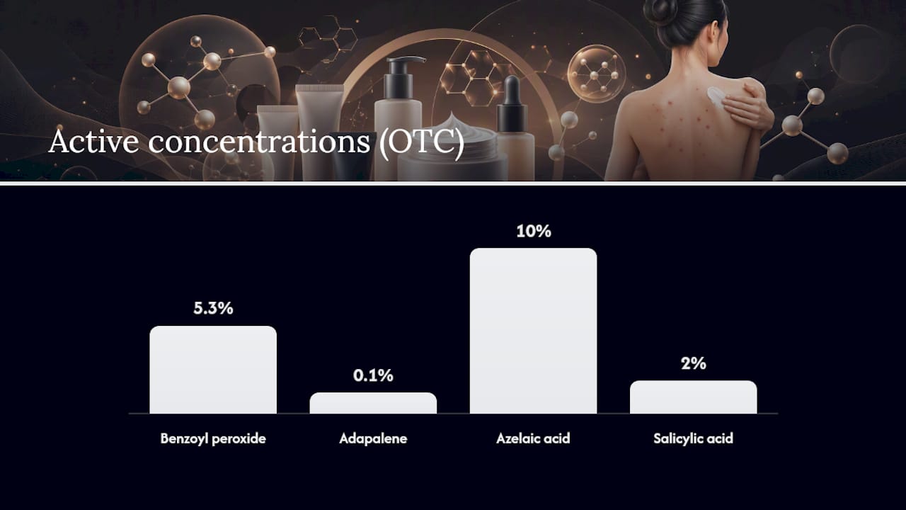 Chart comparing acne treatment ingredients
