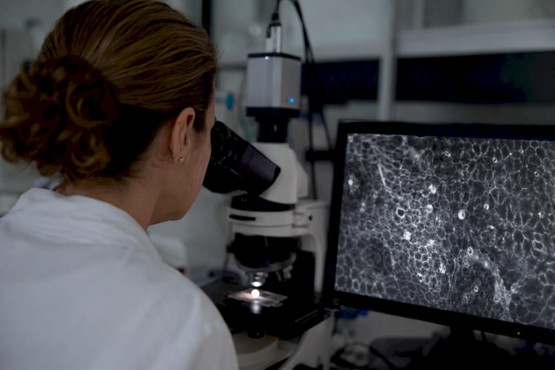 RCM cellular image of melanoma skin lesion