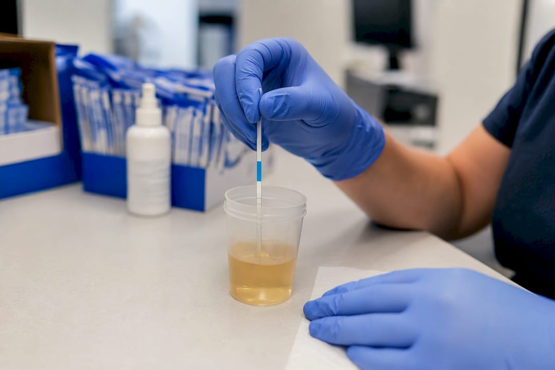 Gloved hand dipping test strip into drug test cup