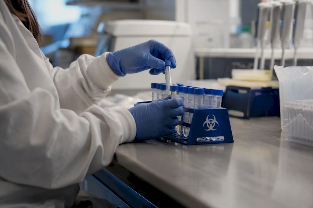 Hands placing diagnostic sample tubes in rack