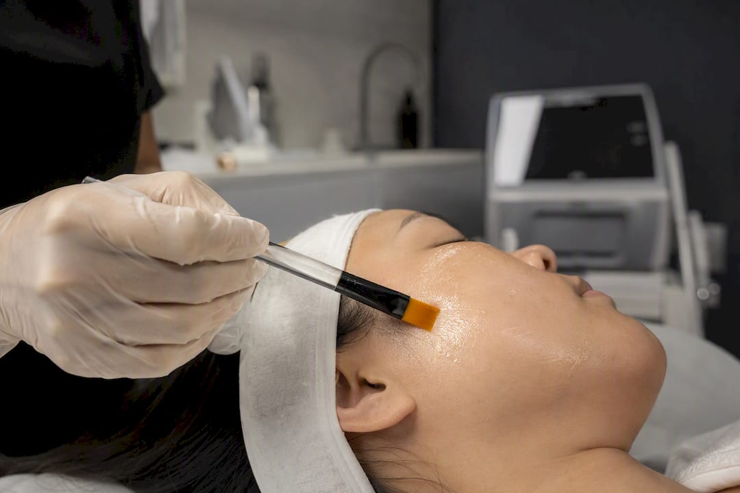 Gloved hand applying chemical peel to cheek