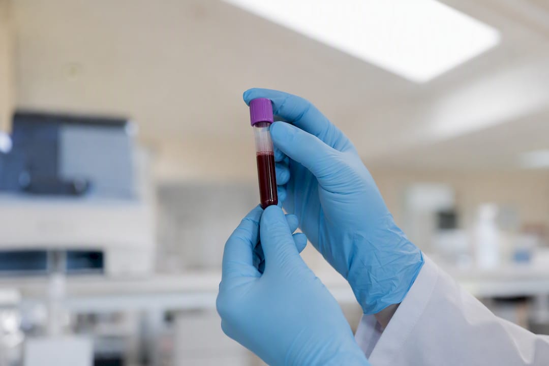 Blood test tube for lactate analysis