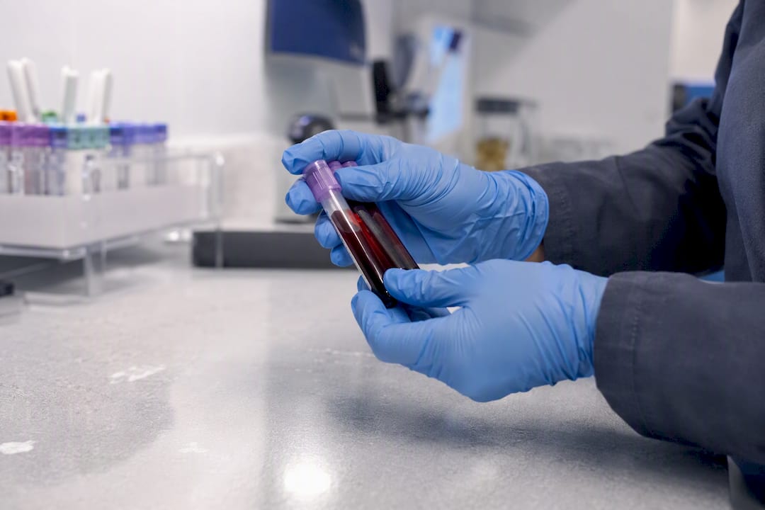 Hands inverting blood collection tubes after filling