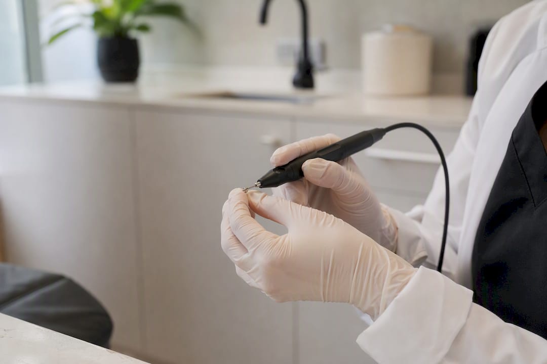 Electrocautery device ready for skin tag removal