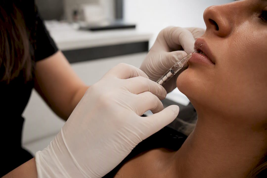 Dermatologist injecting lip filler close-up side