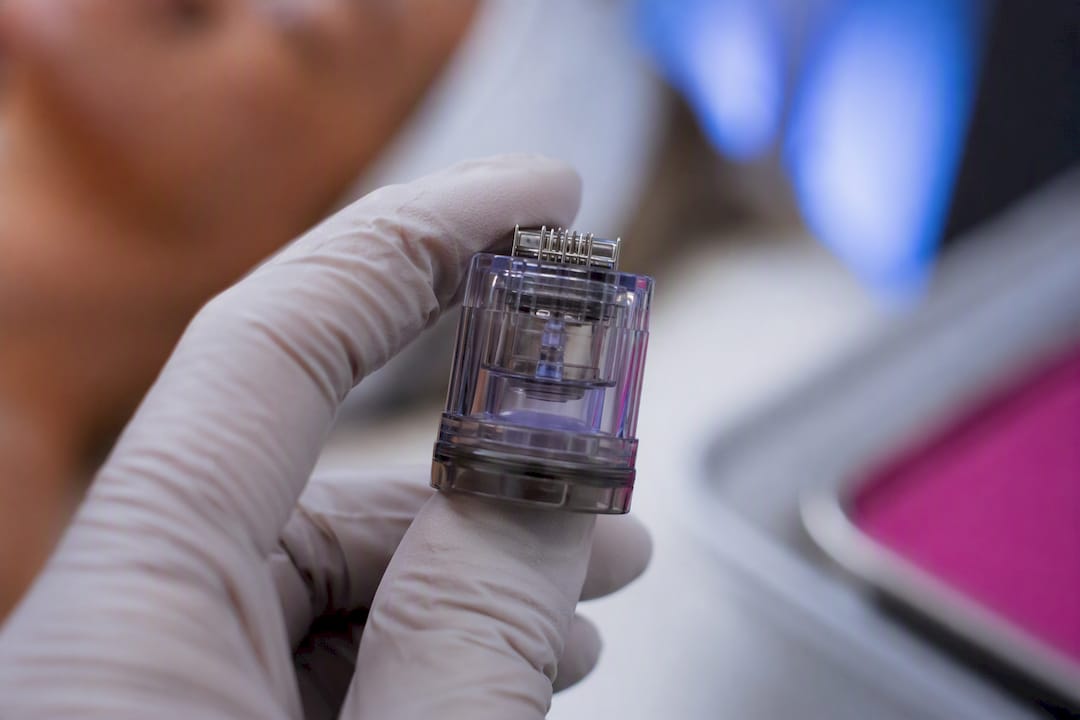 Clinician checking RF microneedling cartridge depth