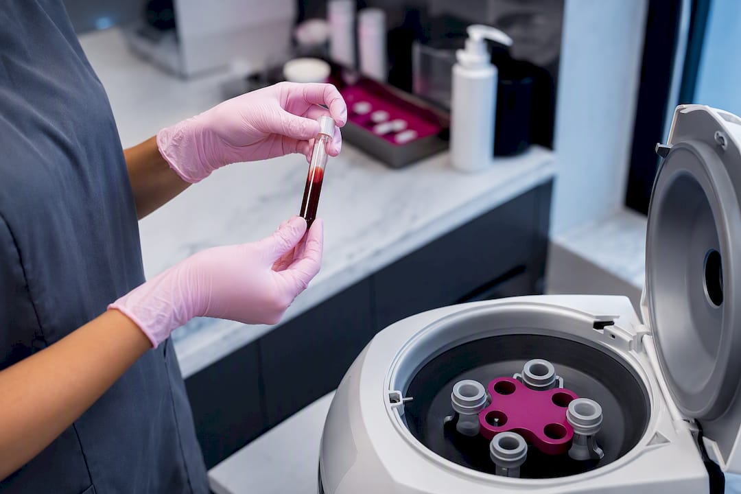 Clinician preparing PRP sample in clinic