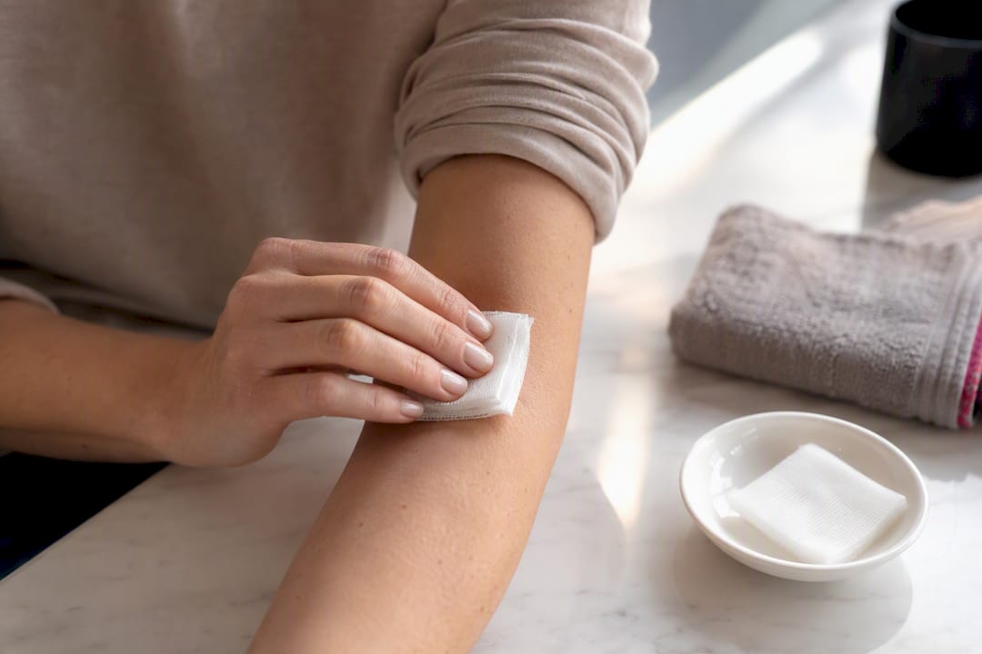 Gauze applying pressure to bleeding skin