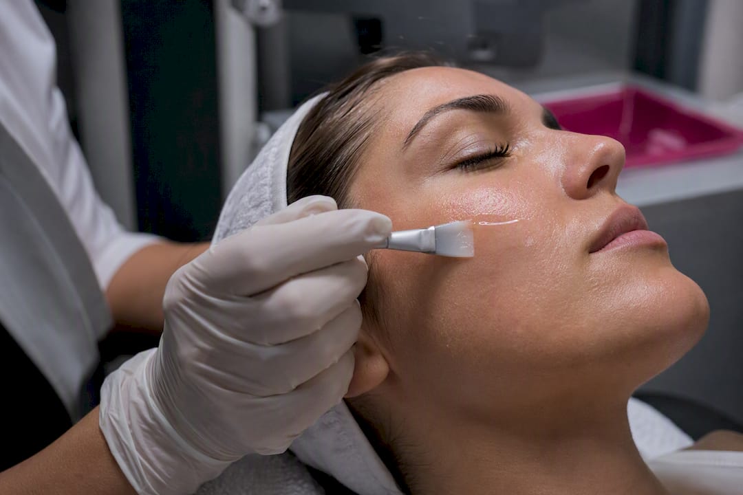 Clinician applying chemical peel to cheek
