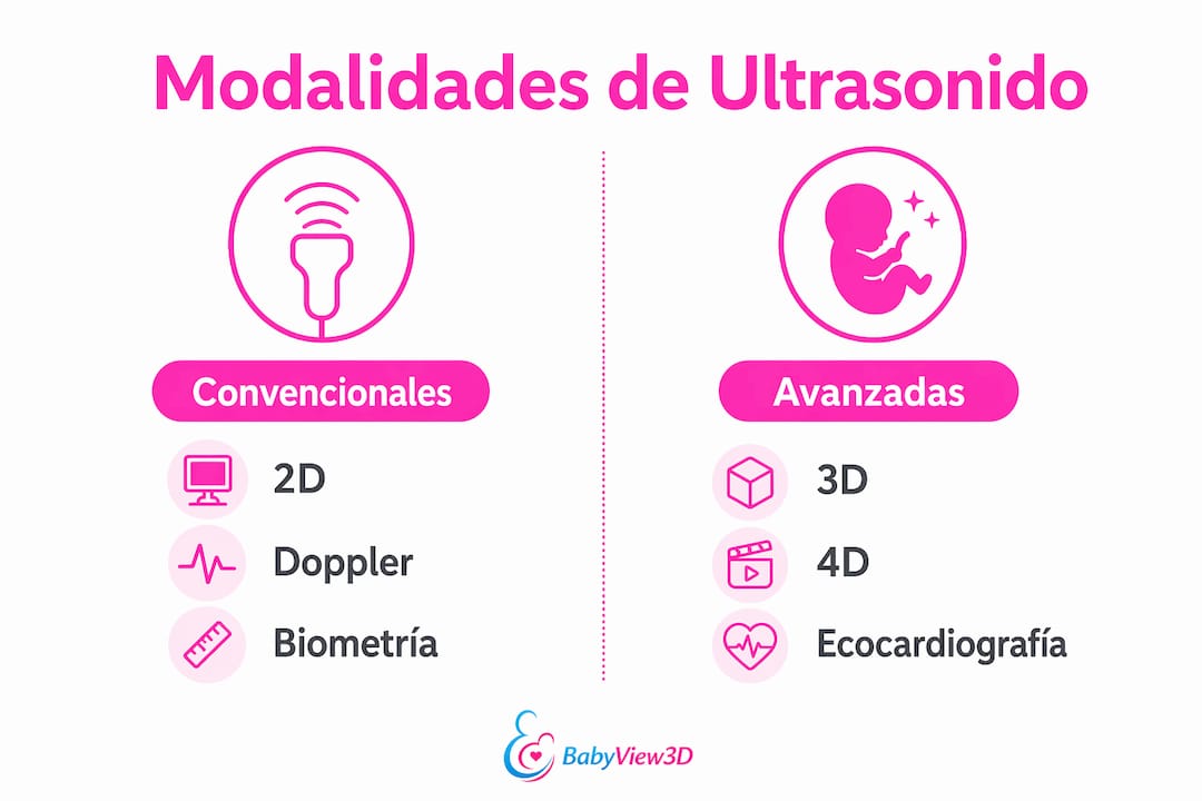 Infografía sobre los diferentes tipos de ecografía prenatal