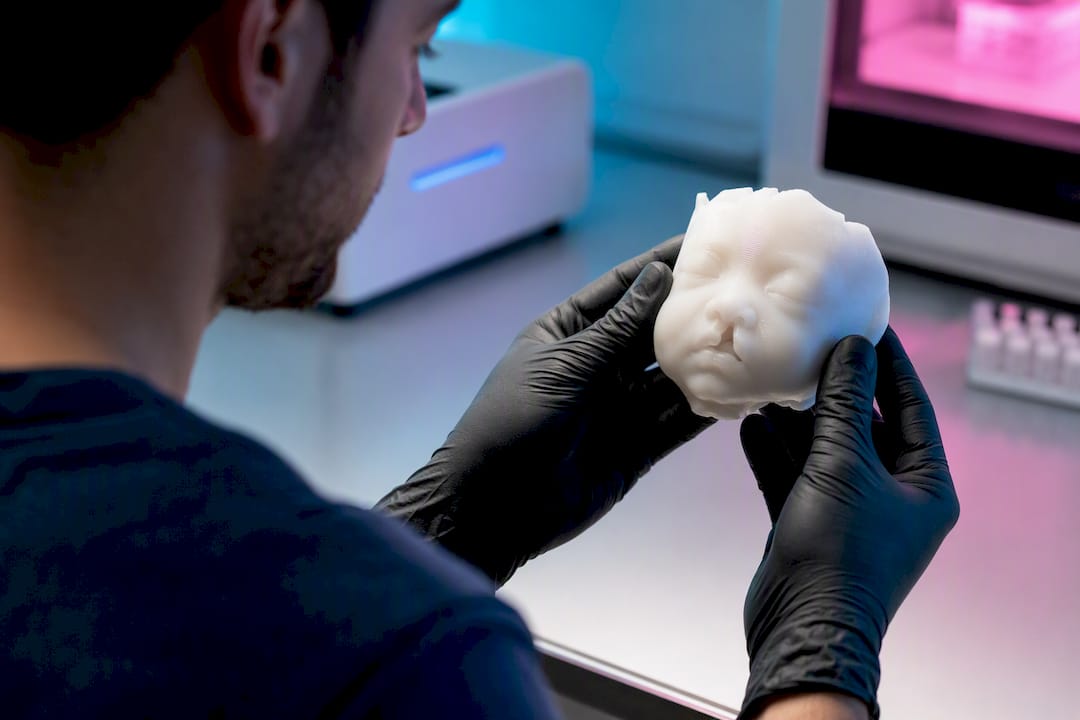 Modelo físico 3D para reconstrucción facial fetal