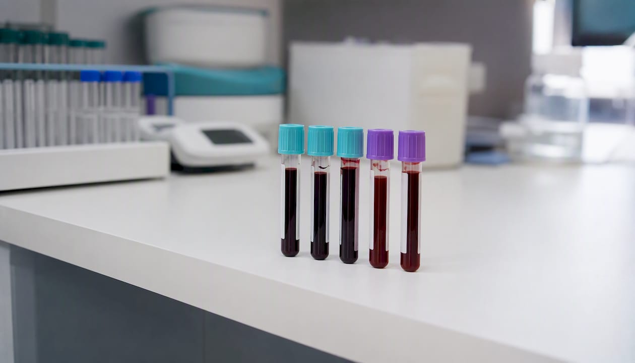 Blood test vials on lab counter