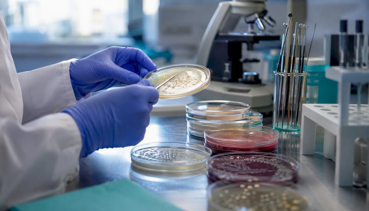 Lab technician handling bacterial culture plates