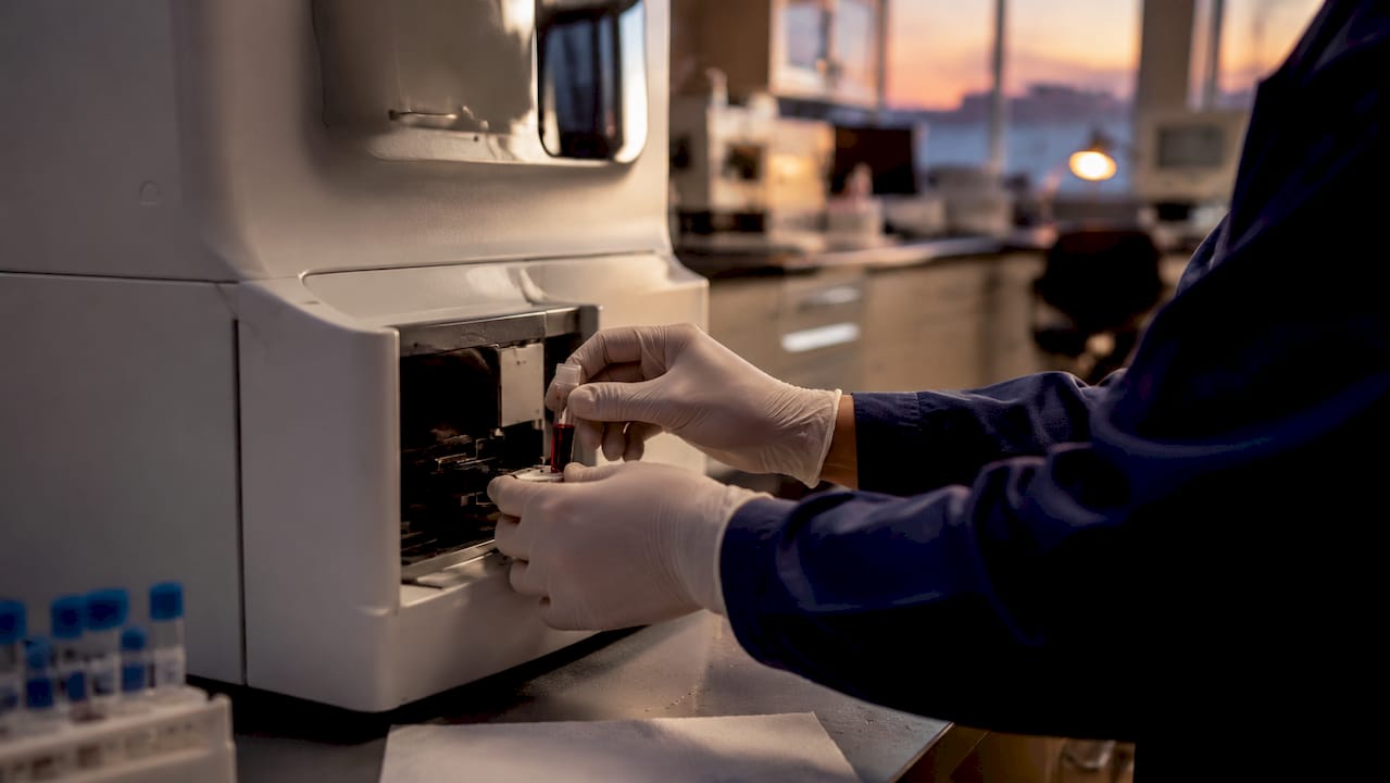 Technician preparing blood sample in hospital lab