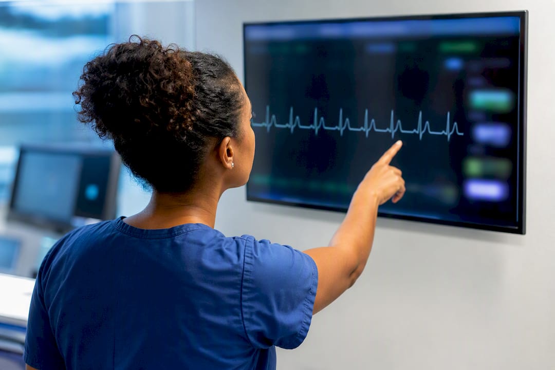 Nurse interpreting ICU cardiac rhythm waveform