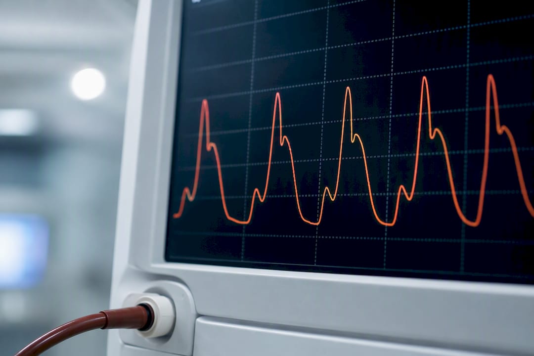 IABP waveform with diastolic augmentation peak