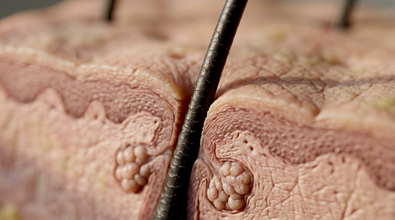 Macro photo of scalp showing hair follicle infundibulum