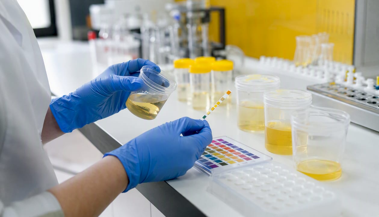 Lab technician testing urine sample