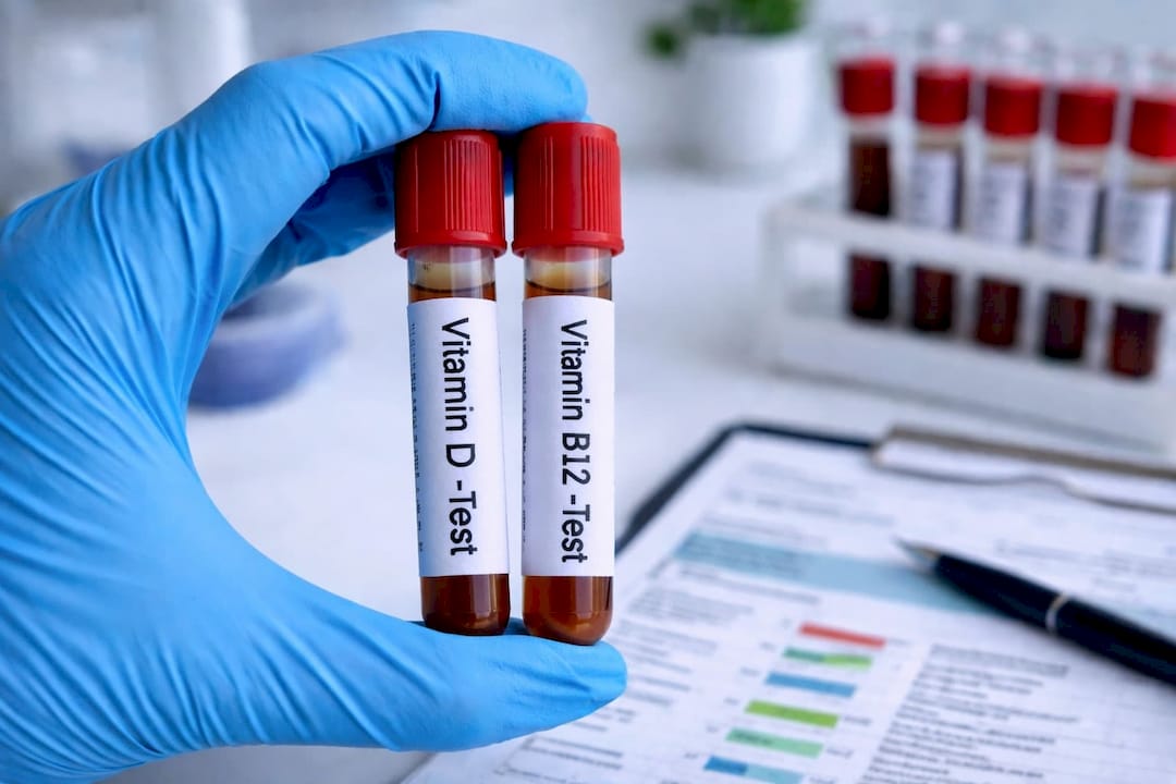 How to interpret blood tests for 7 common vitamin deficiencies ...