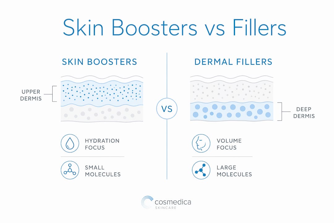 Infographic comparing skin boosters and dermal fillers