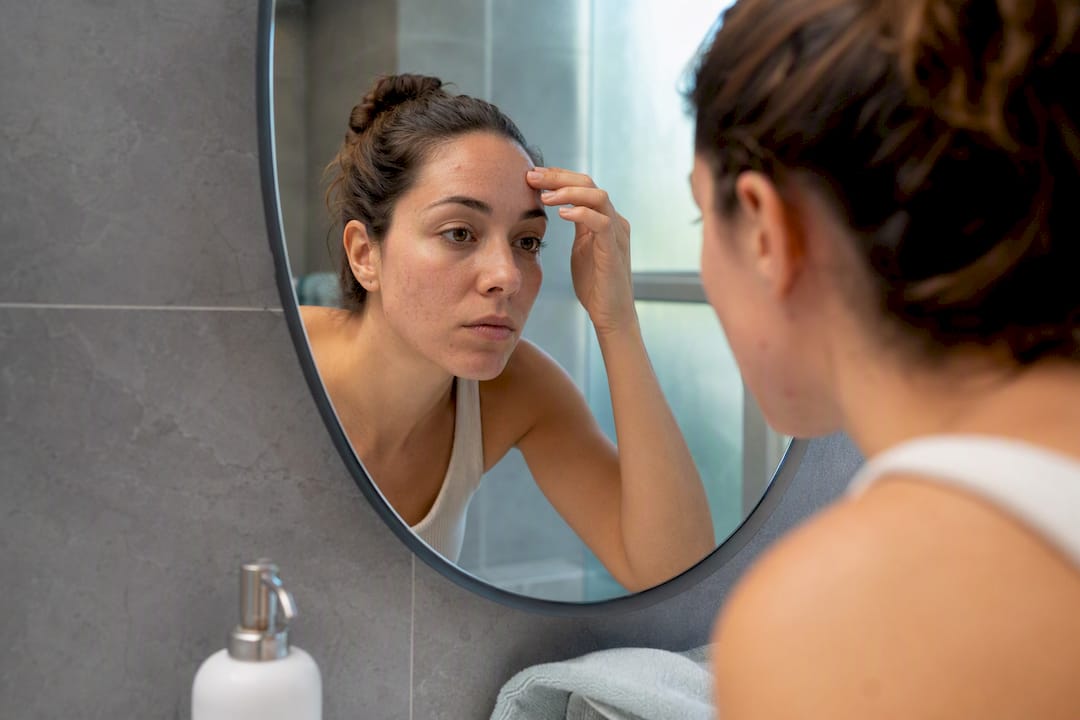Woman looking closely at blemishes on jawline in mirror
