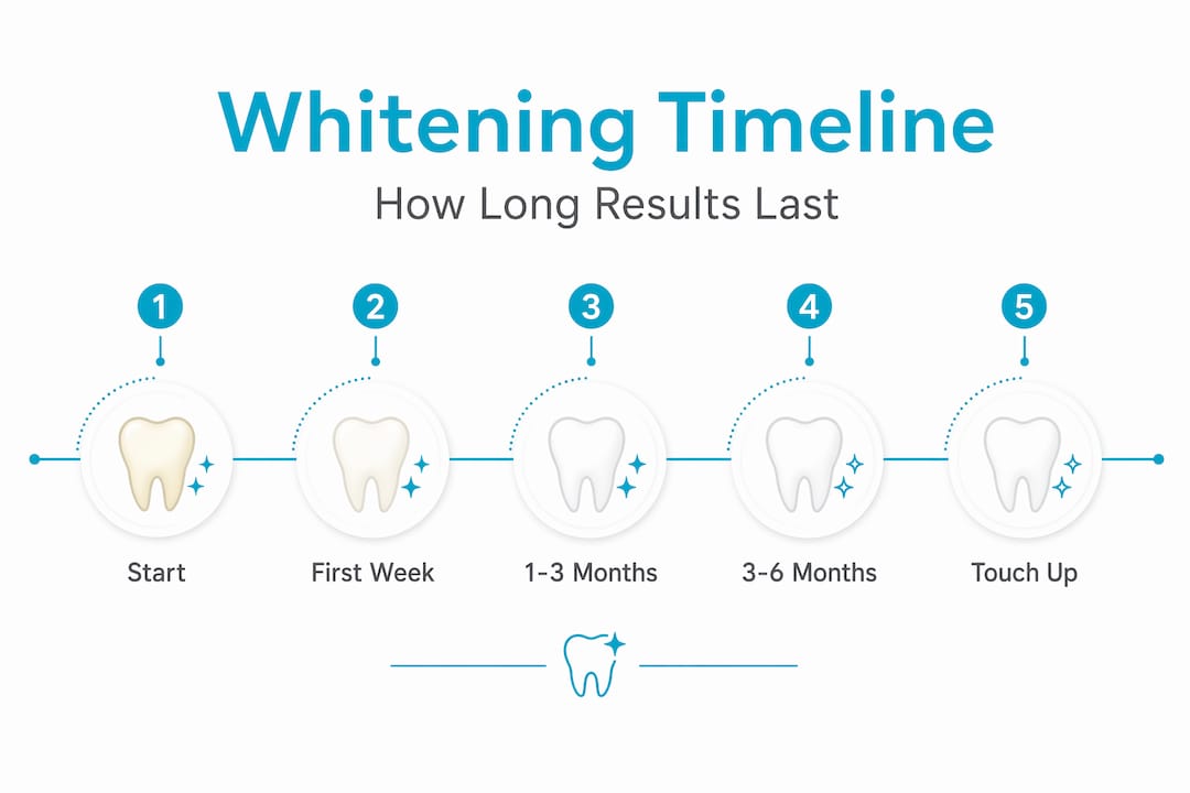 Infographic of teeth whitening results timeline
