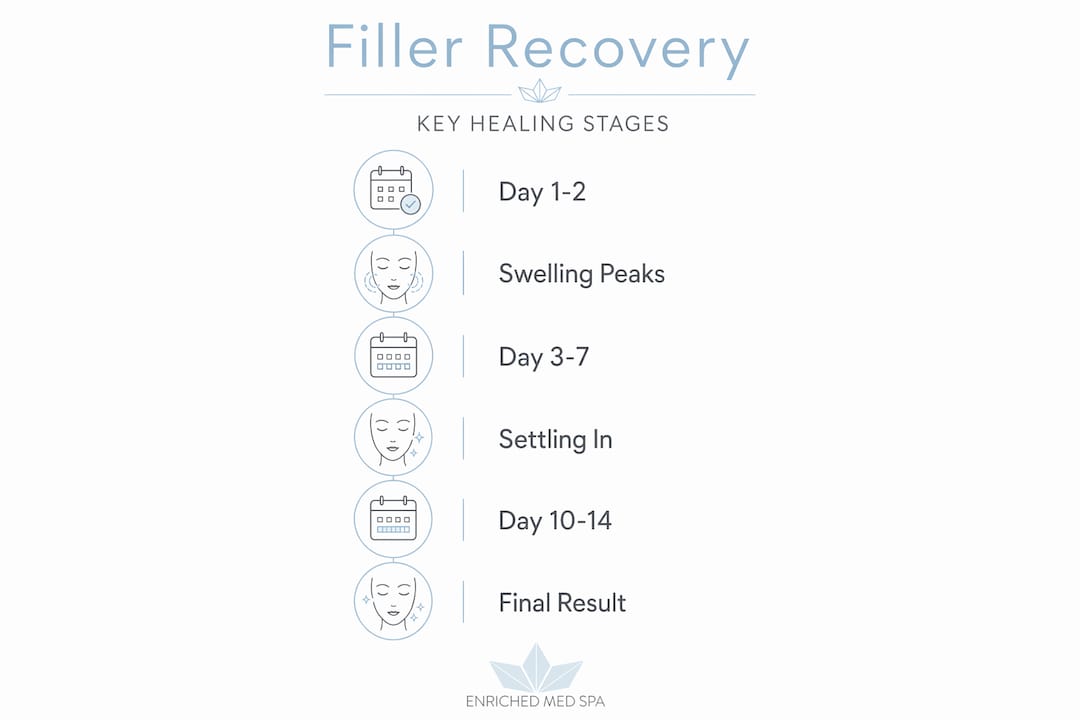 Infographic showing recovery steps after fillers