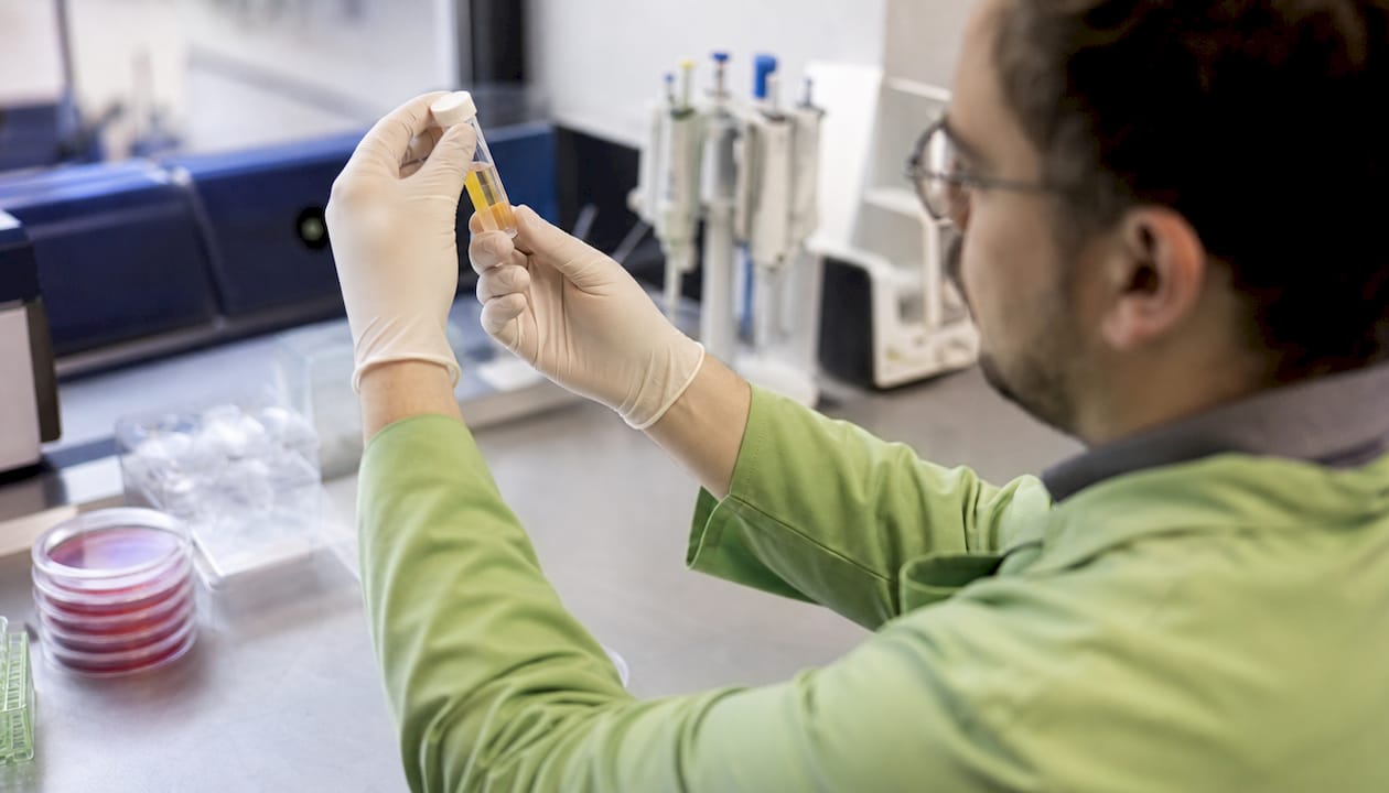 Scientist holding PRP vial in lab