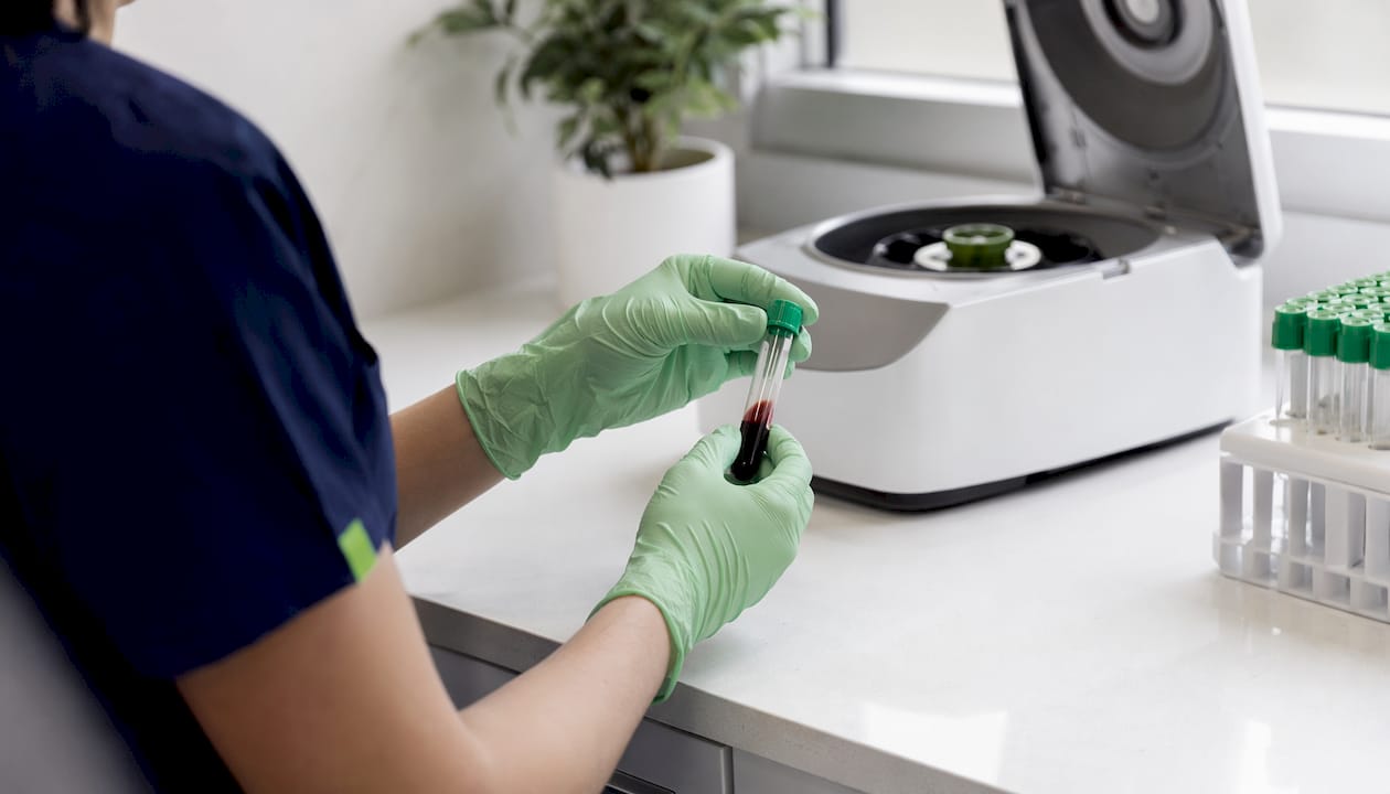 Lab technician preparing PRP blood sample