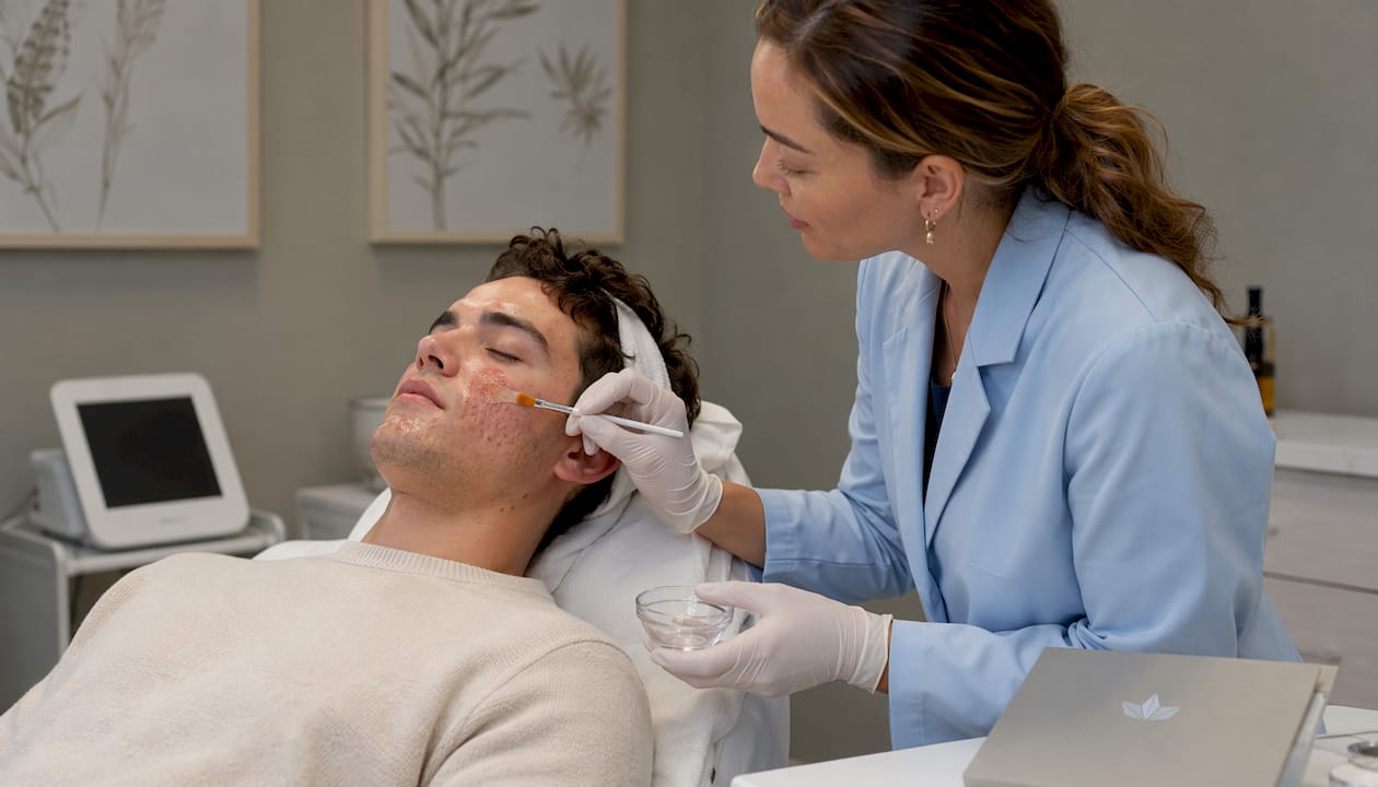 Clinician applying chemical peel to male acne patient