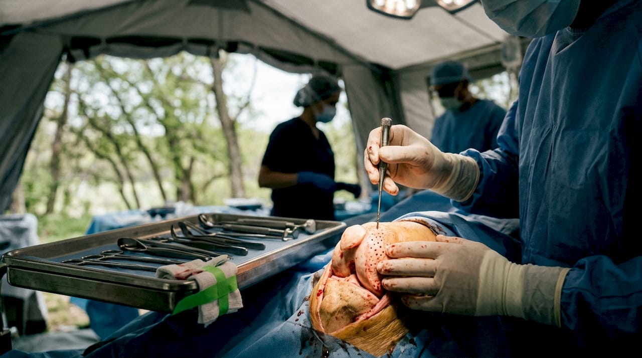 Surgeon performing microfracture knee surgery close-up
