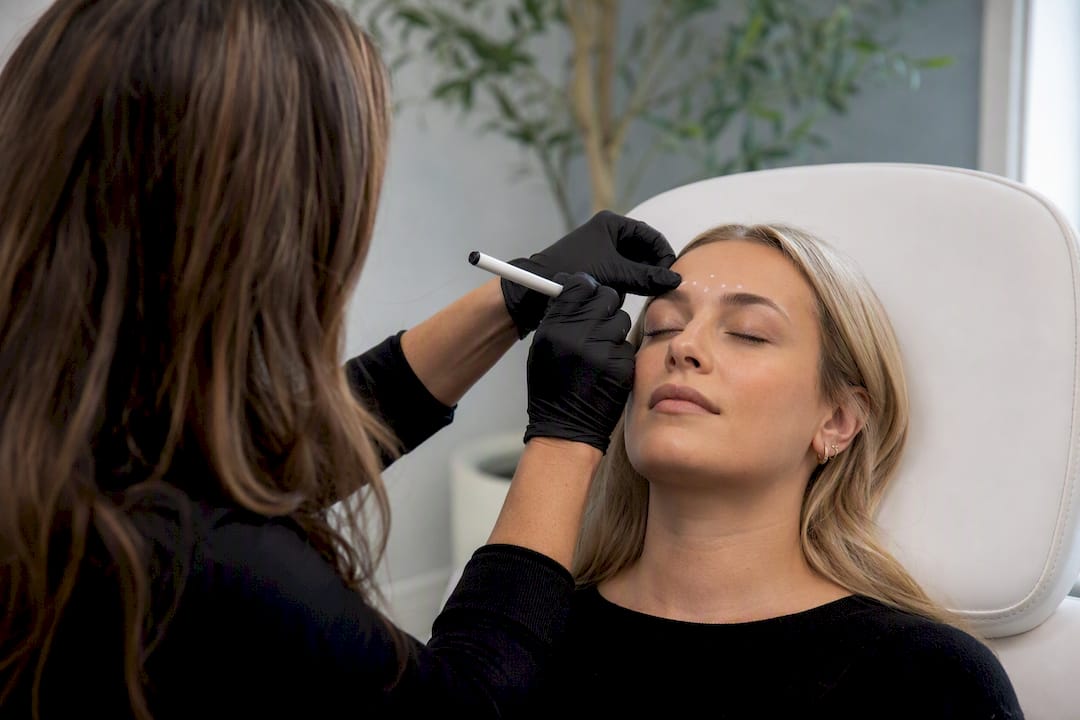Clinician marking forehead for Botox injections