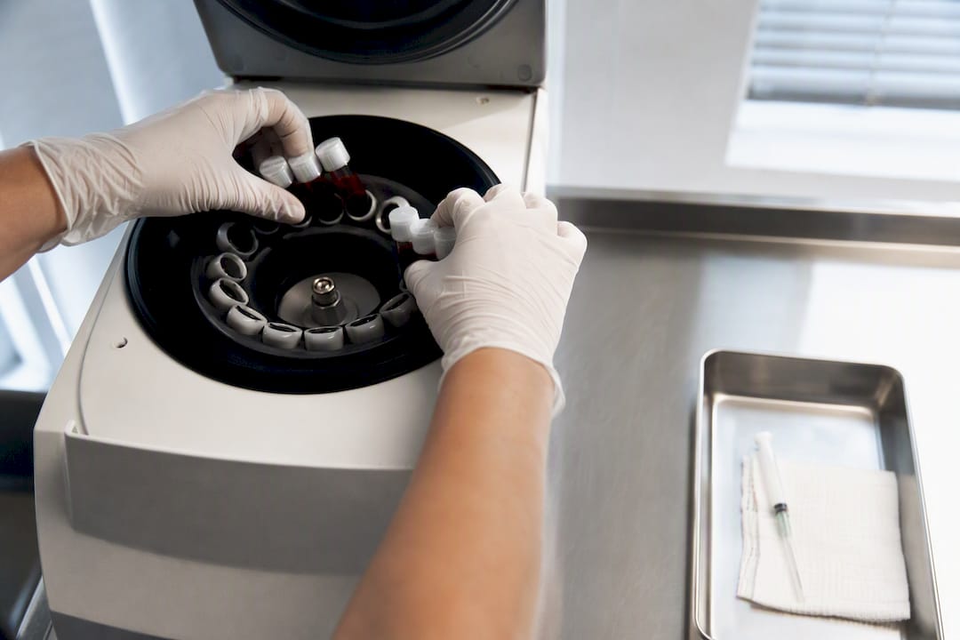 Blood tubes prepared for PRP centrifugation