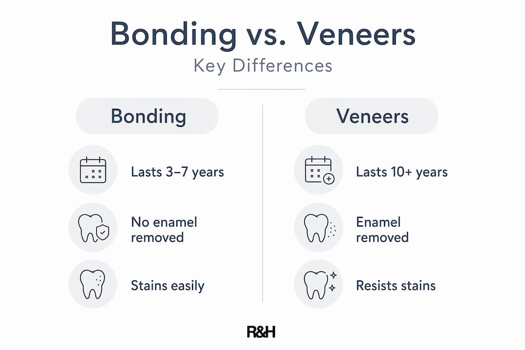 Infographic comparing bonding to veneers features