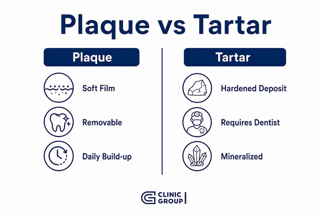 Infographic comparing plaque and tartar features
