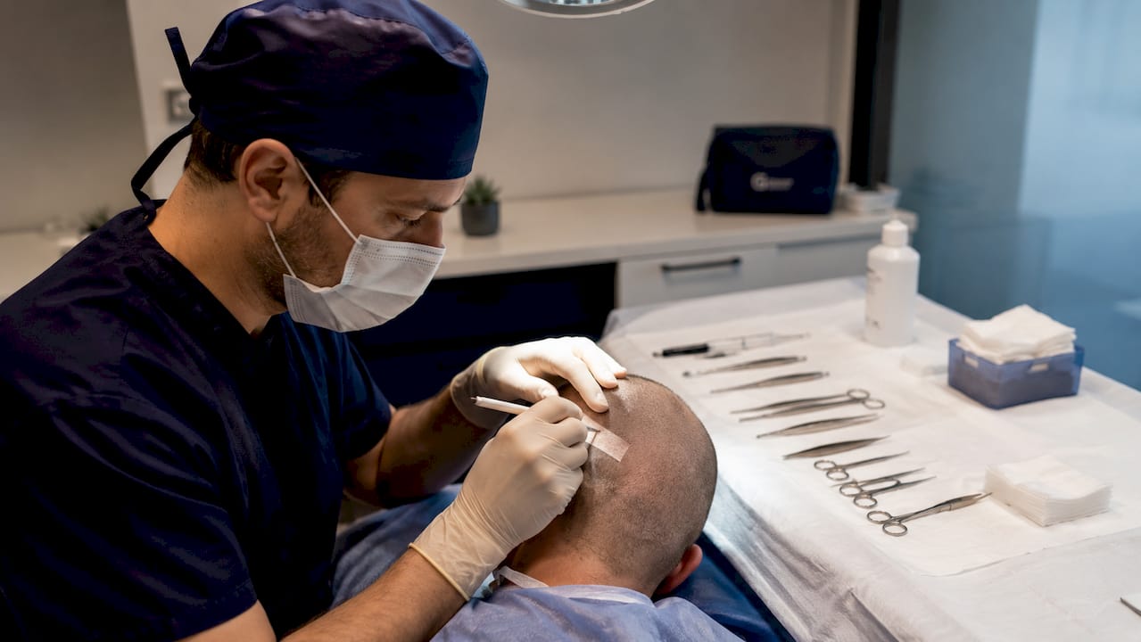 Il medico si appresta a eseguire un trapianto di capelli con tecnica FUT.