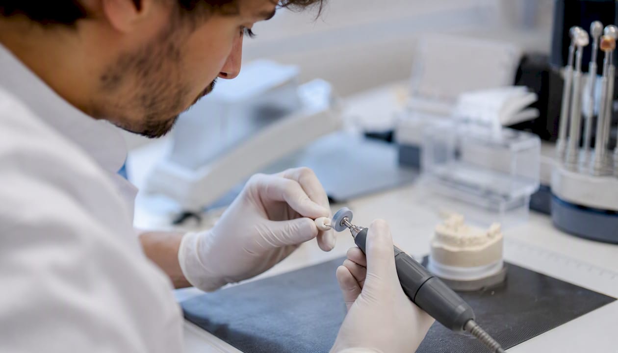 Le mani di un odontotecnico perfezionano una faccetta in disilicato di litio nel laboratorio odontotecnico.
