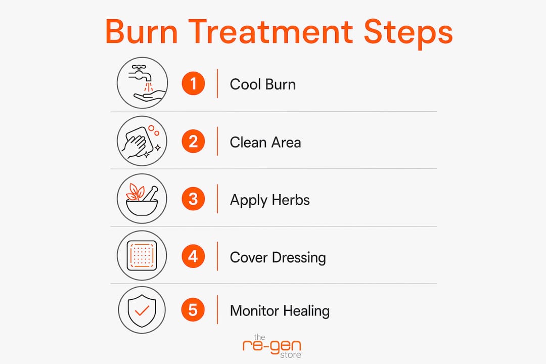 Infographic illustrating herbal burn treatment steps