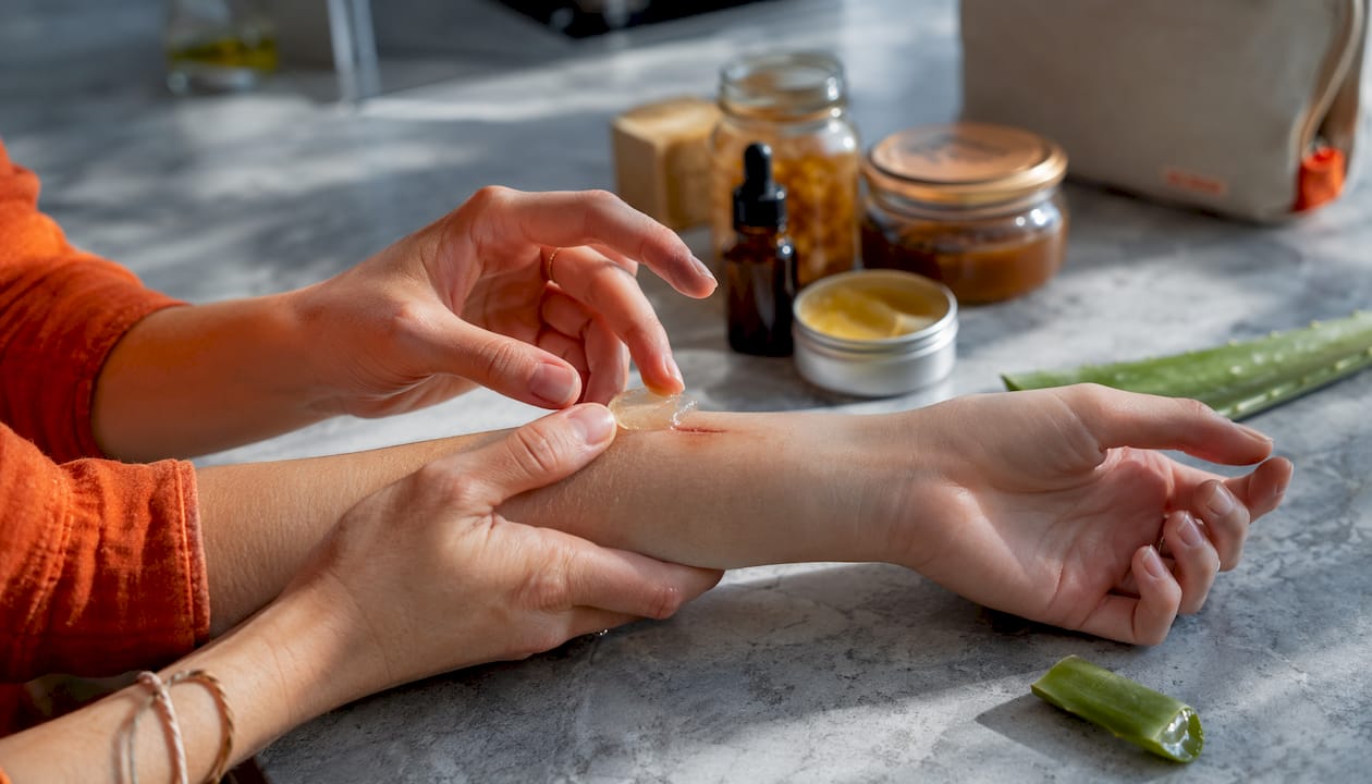 Hands applying aloe vera gel to minor wound