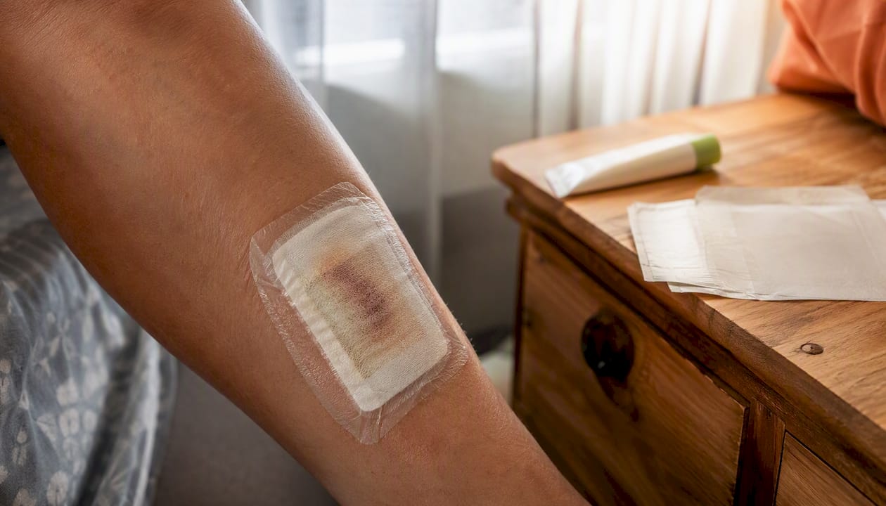 Close-up of moist wound dressing on arm
