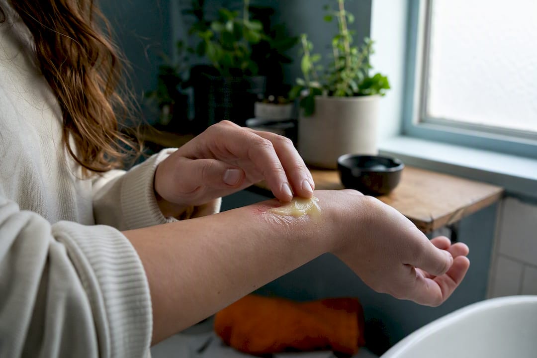 Hands applying plant-based ointment on skin